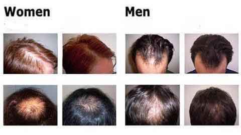 organic hair growth essence